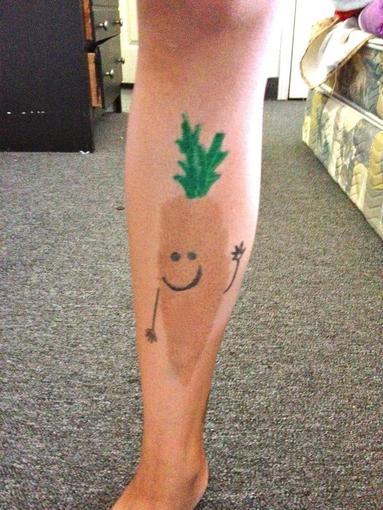 Im late for the whole birthmark drawing thing but I dont carrot all