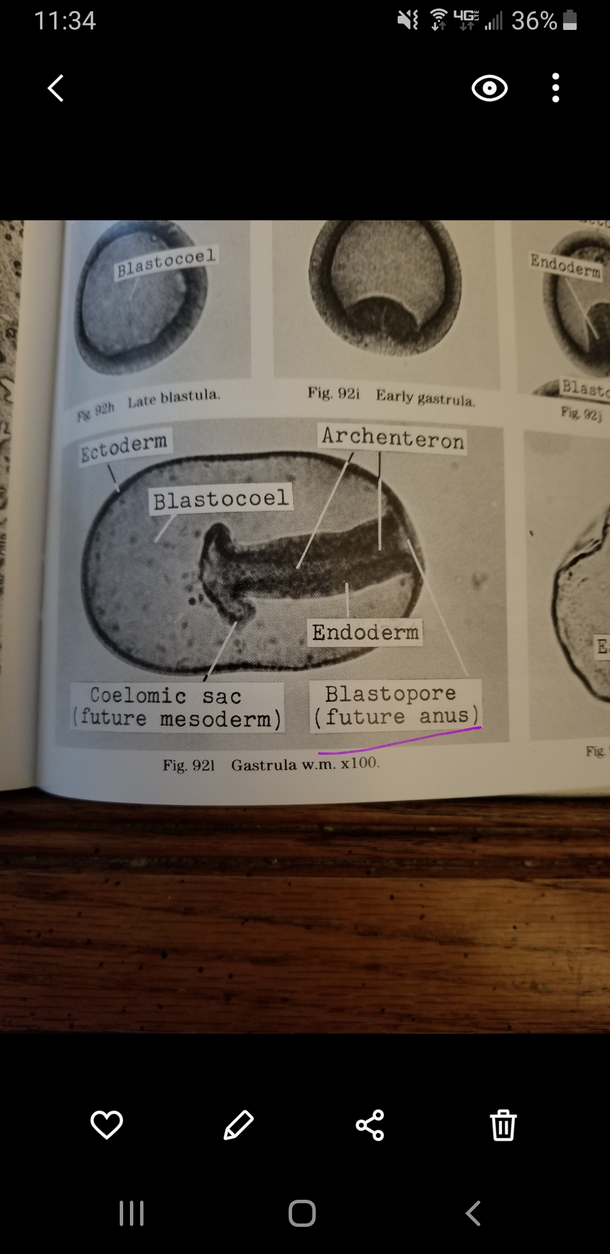Im studying embryology and just learned were all born assholes