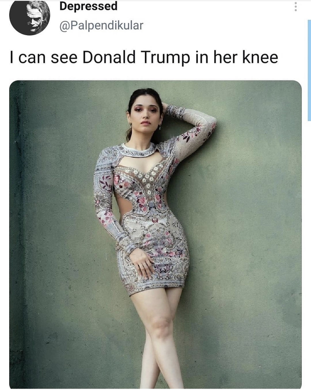 KNEE L Peaasents