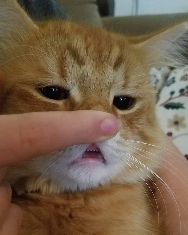 Look at my teeth
