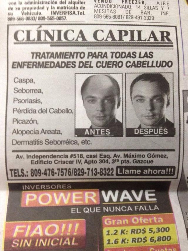 Mexican hair restoration clinic saves Blockbuster TV show