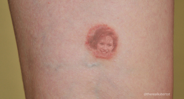 Molly Ringworm