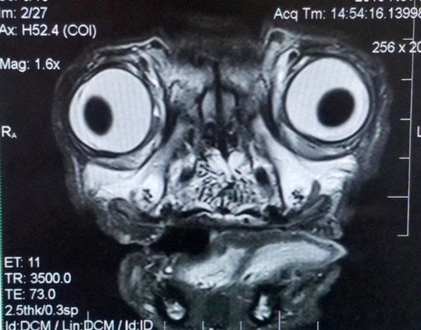 MRI scan of a Pug - Meme Guy