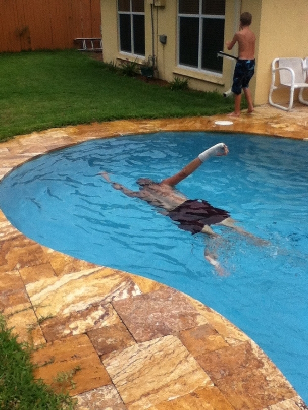 My dad broke his hand but insisted on swimming with the cast