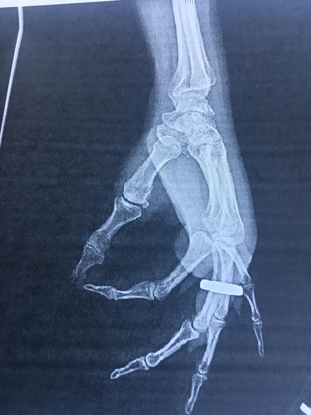 My dads X-ray