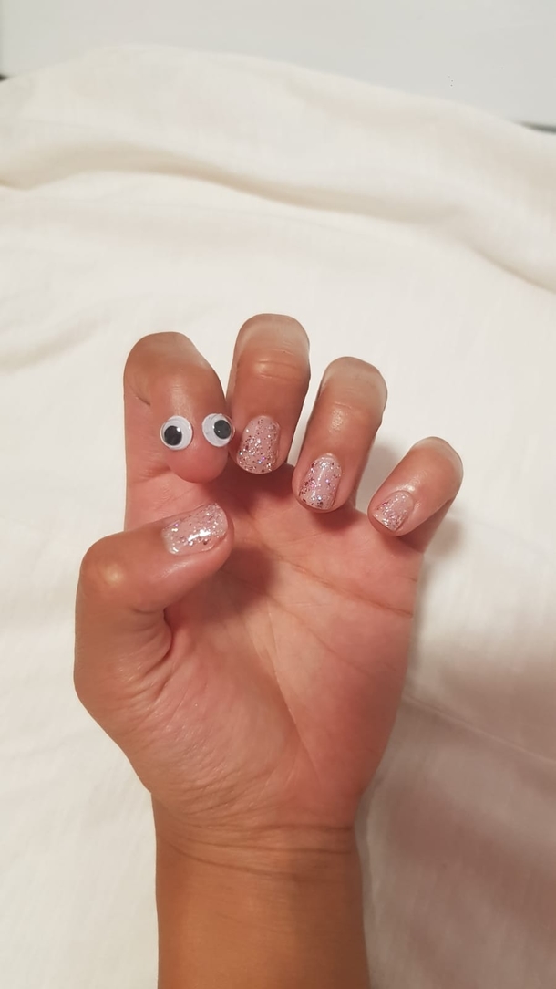 My GF was born without a nail on a finger So due to popular demand we put google eyes on it