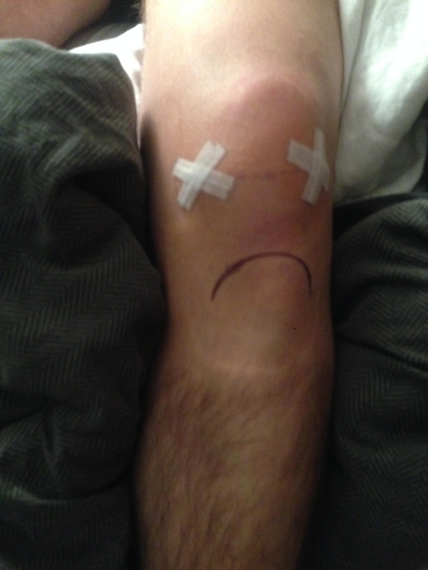 My girlfriend thought my knee looked pretty sad after ...