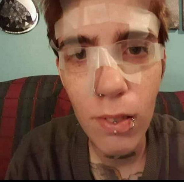 My glasses broke