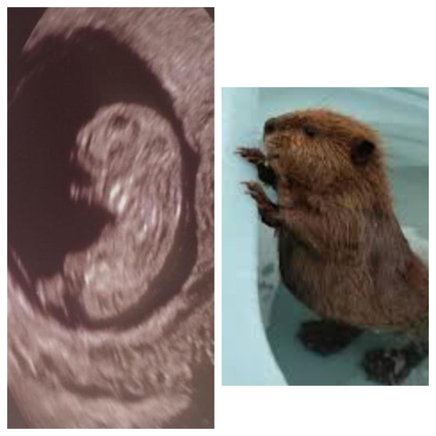 My sisters baby sonogram reminds me of a beaver