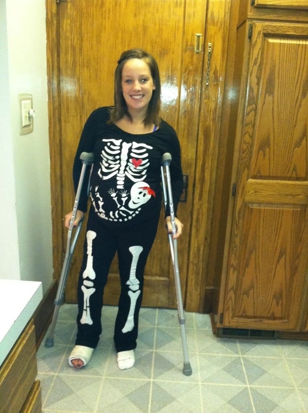 My wife was in a car accident Her friend made her this Halloween costume She is also pregnant