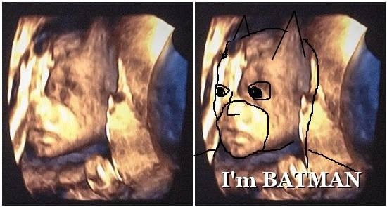 My wife was so upset with me after I pointed out something in our ultrasound Cant be unseen