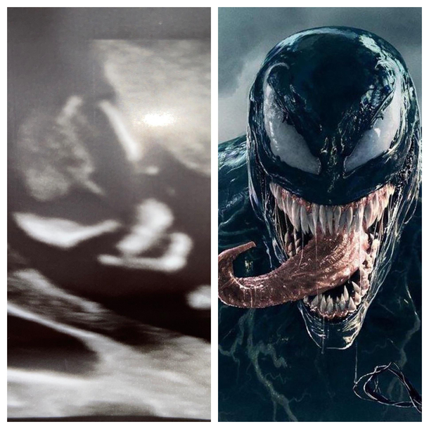 My wifes ultrasound seems ominous That is its face