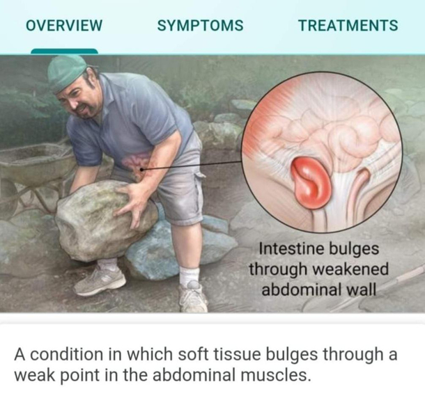 On one hand Im offended by the dad stereotype being a PSA for hernias On the other this absolute unit is tossing k stones like nbd