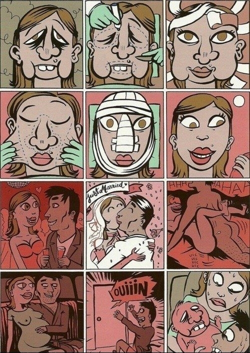 Reasons not to marry someone after plastic surgery
