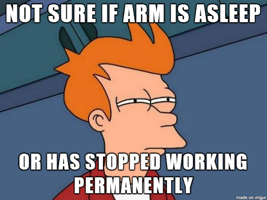 Severed my brachial artery a few years ago I go through this entirely too often