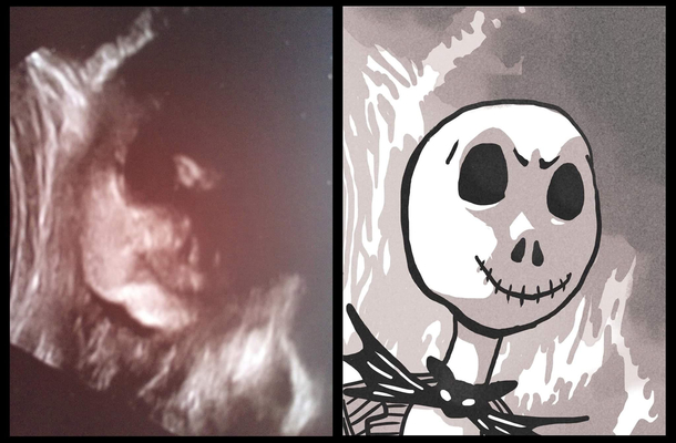 So we had an ultrasound today