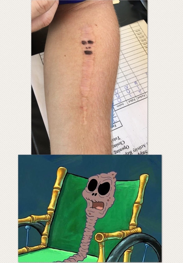 Striking Resemblance A friends scar