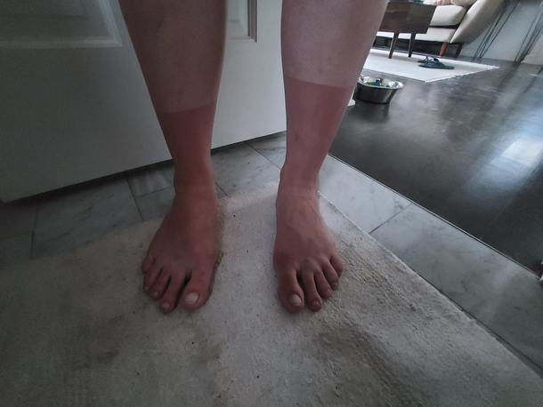 Sunburn Socks