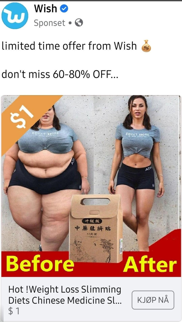 Surprise its just a box of tapeworms