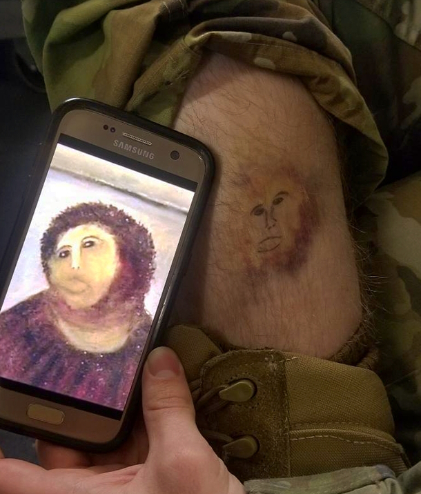 The bruise on my leg looked familiar