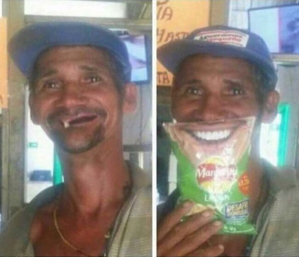 The difference teeth makes