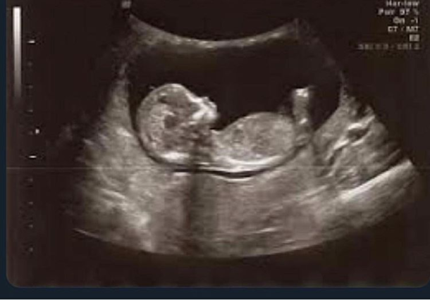 The last time someone was excited to see me