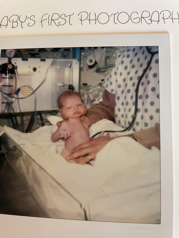 The NICU nurses called me ET as did my mother