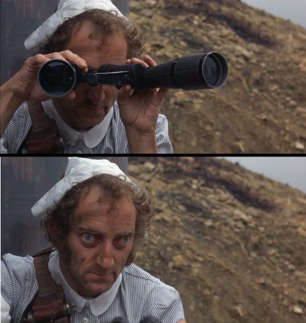 The school nurse trying to remove a splinter from your finger