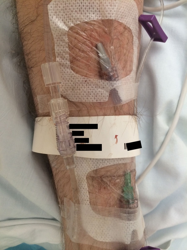 The surgery got it all so we wont have to do chemo My body gave this an upvote