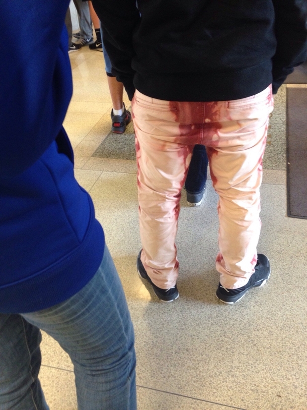 Those pants are not dope dawg