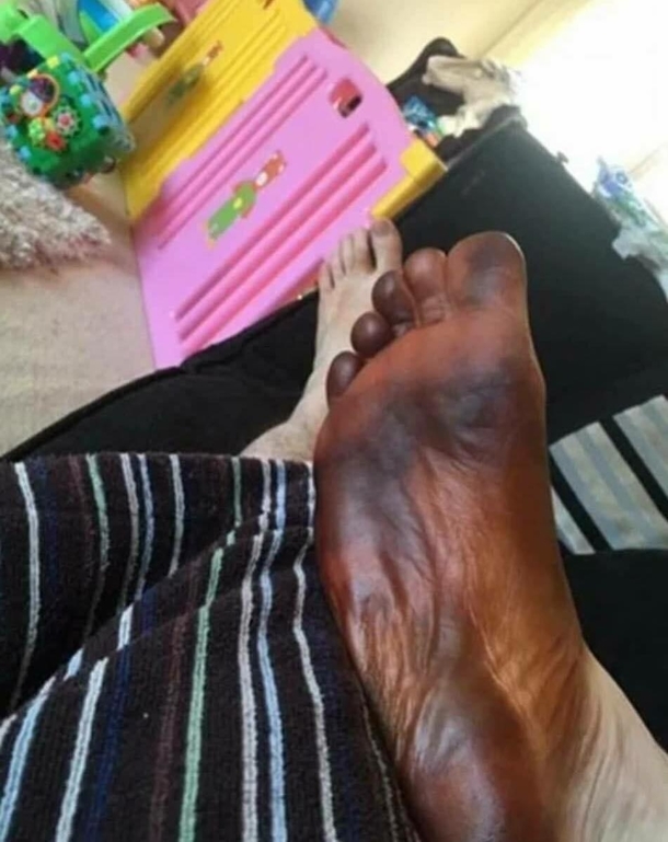 Thought my foot was going to drop off then realised my mrs has been using my sock to apply false tan