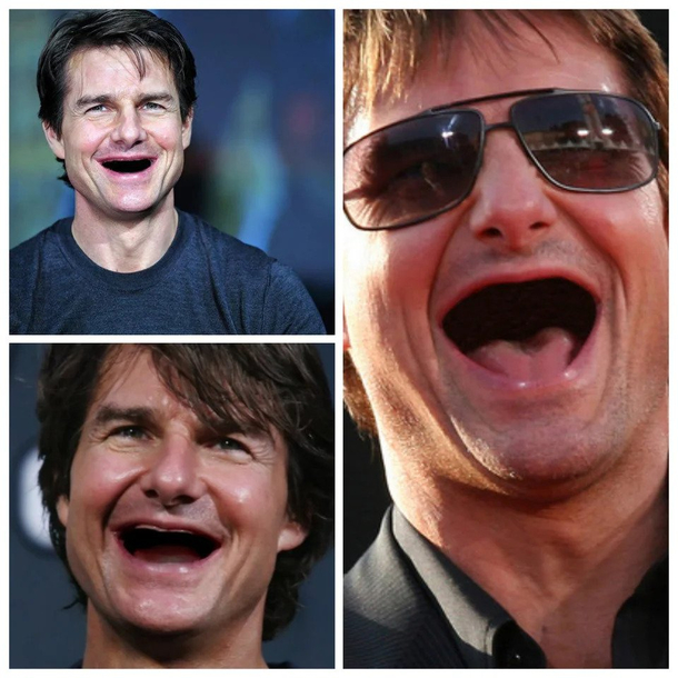 Tom Cruise without teeth