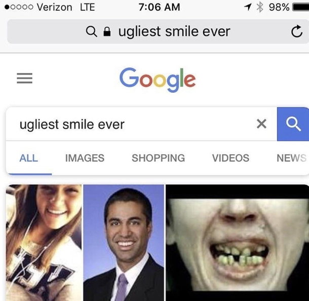 Ugliest Smile Ever