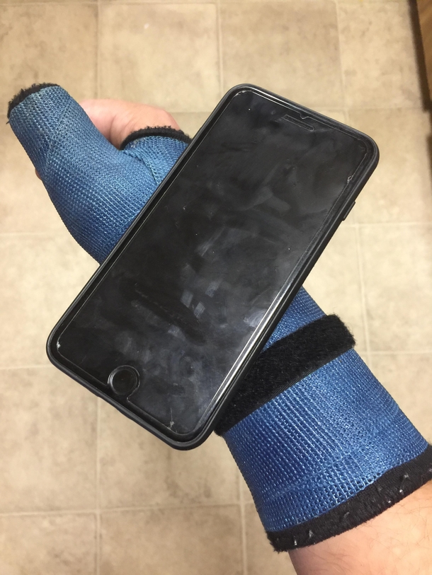 Velcro iPhone and a cast I call it the broke mans Apple Watch