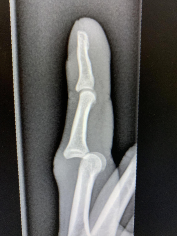 when the FINGER GAME too STRONG
