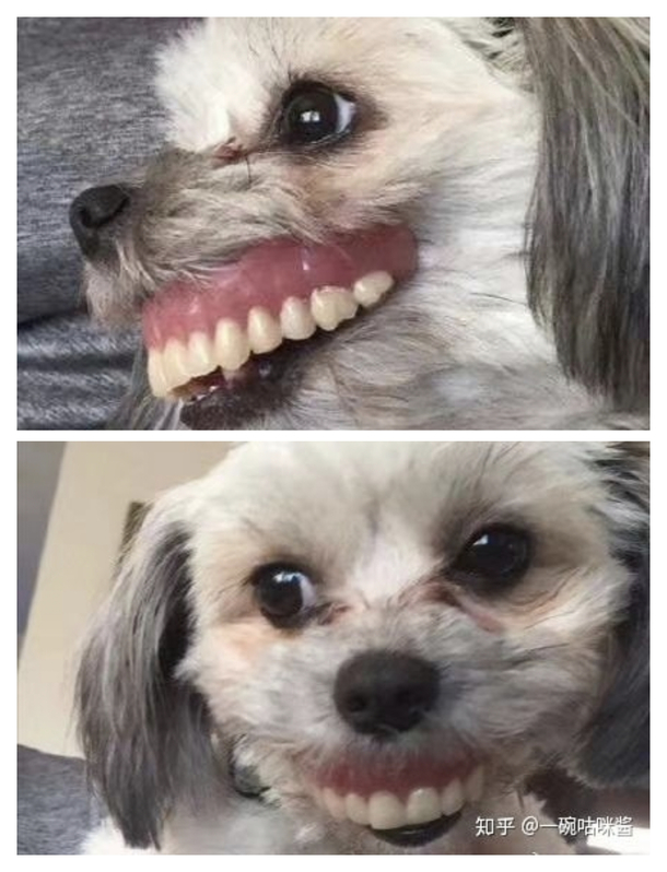 Where are my dentures