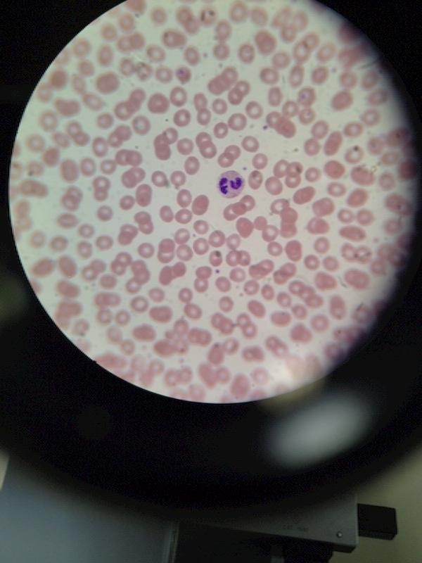 White blood cell speaking its mind