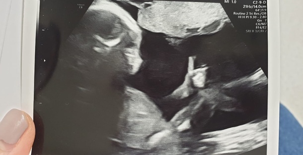 Wife was worried about our baby Think hes trying to tell us something