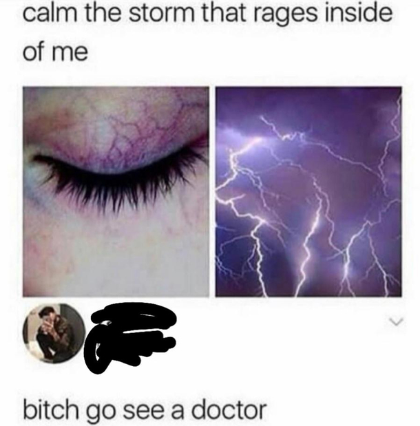 Yes do see a doctor