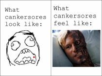 Cankersores