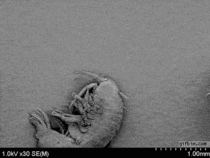 A tiny bacterium on a diatom on an amphipod