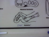 At the podiatrist