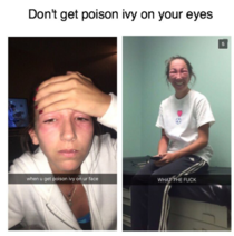 Dont get poison ivy on your eyessaw this over on instagram