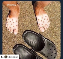 Dont wear crocs in the sun