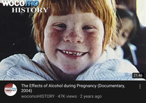 Drinking alcohol during pregnancy may result in giving birth to a ginger