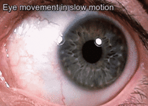 Eye movement in Slow motion