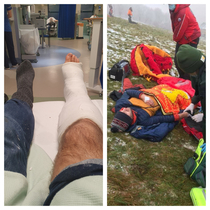 Finished the year by dislocating my ankle and fracturing my tibia amp fibula on a kids sledge - causing me to wait  mins in the snow before being recovered by Mountain Rescue 