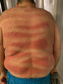 First day at the beach and my wife made sure I was protected from sunburn by spraying my back with sunscreen I cant see back there- did she do a good job