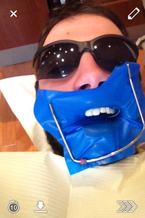 For those of you who want to know what you look like when you go to the dentist