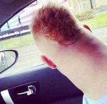 Found this on r hmm I thought it belonged here its a hairy thumb with ears